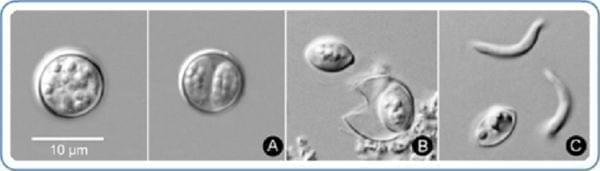 The microscopic parasite Cyclosporia cayetanensis, which causes Cyclosporiasis.